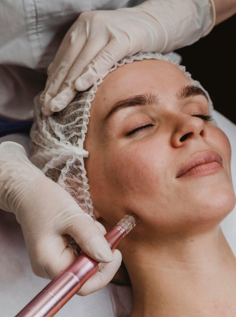 woman getting microneedling done