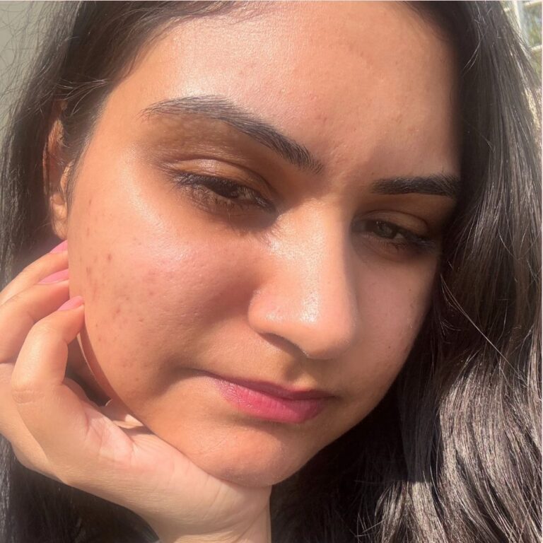 How To Clear Your Skin In 30 Days